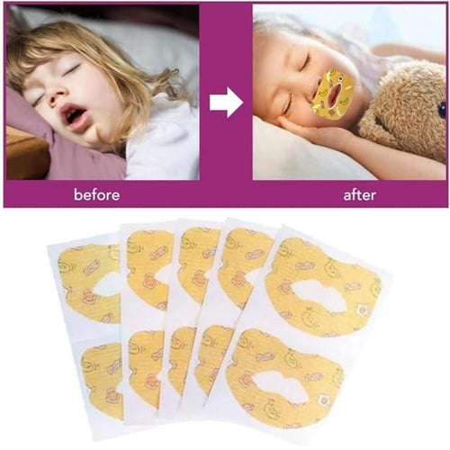 Anti Snoring Sticker for Children and Adult 30 Pcs